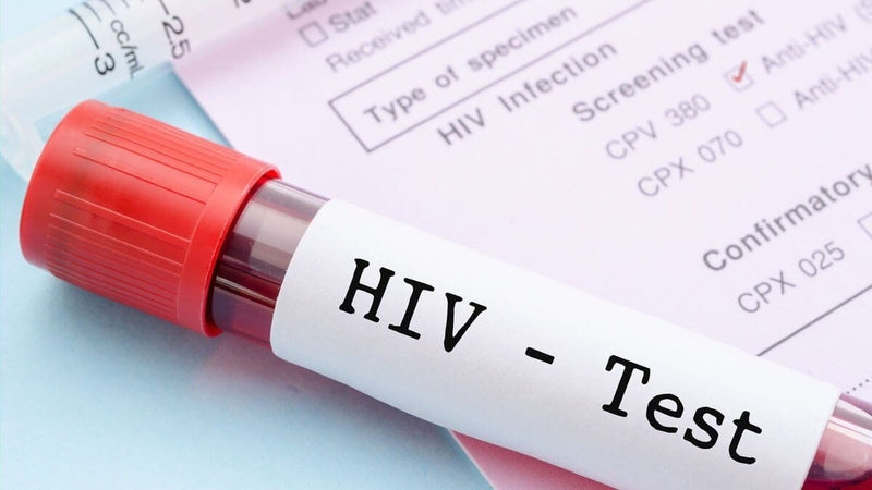 Xét nghiệm bệnh truyền nhiễm không thể thiếu trong danh mục khám sức khỏe sinh sản