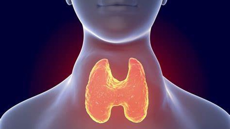 Carcinoma tuyến giáp thể nhú: Hiểu rõ về bệnh lý và cách điều trị hiệu quả 3