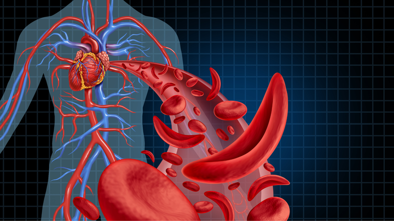 Cardiovascular disease là gì? 1