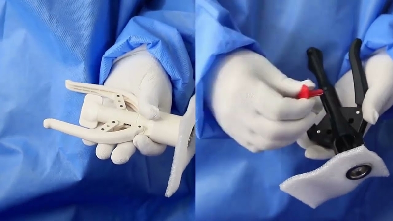 Cắt bao quy đầu bằng máy: Ưu và nhược điểm 2