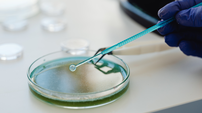 Cắt bao quy đầu ở nam giới có thể bảo vệ chống lại nhiễm HPV ở cả nam và nữ 3