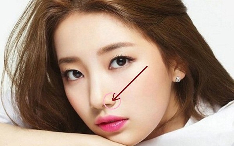 Cắt cánh mũi là kỹ thuật thu gọn cánh mũi bằng cách thực hiện tác động từ bên ngoài khoang mũi