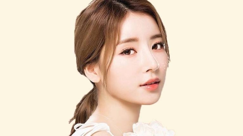 Cắt cánh mũi có cao hơn không phụ thuộc vào cấu trức khuôn mặt của từng người