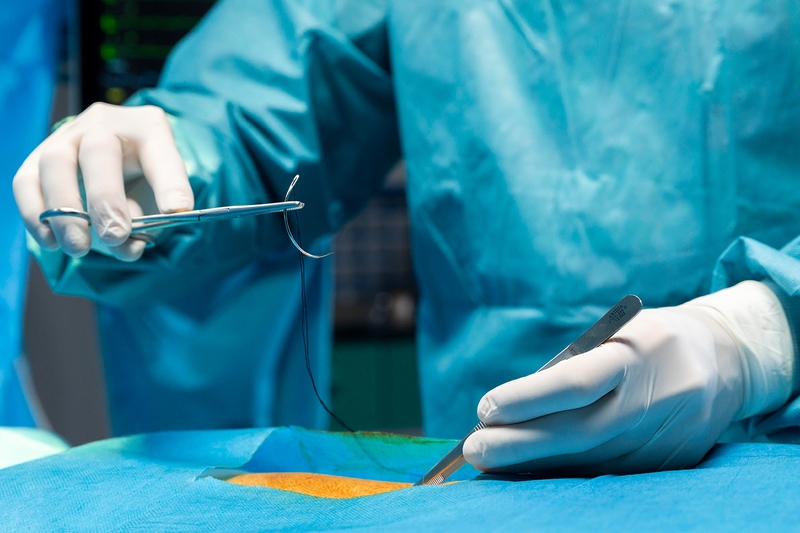 Cắt chỉ còn sót có sao không? Các loại chỉ khâu trong phẫu thuật3