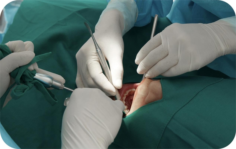 Cắt lợi bao lâu hết chảy máu? Những điều cần lưu ý sau khi cắt lợi1