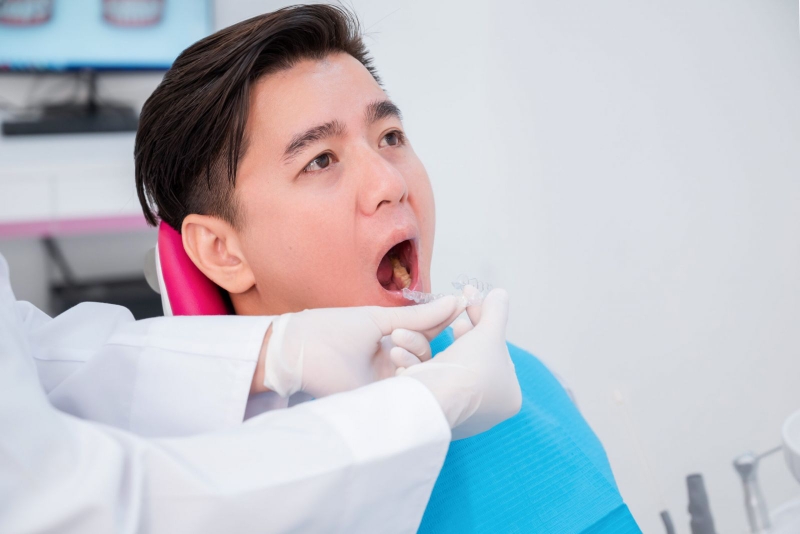 Cắt lợi khi niềng răng có được không? Niềng răng có hết hở lợi không? 2