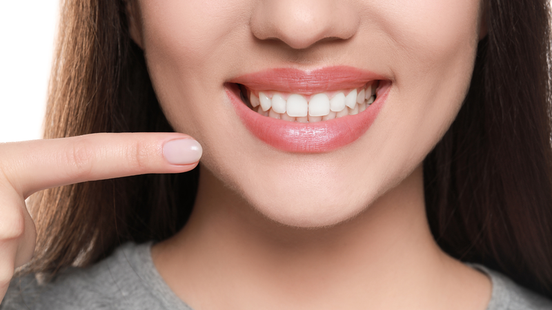 Cắt lợi thẩm mỹ bằng laser giúp khôi phục lại dáng răng cân đối với khuôn miệng