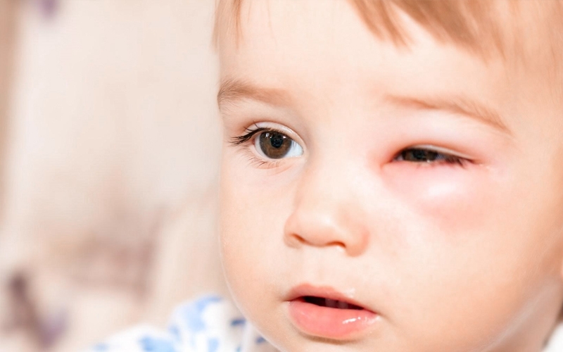 cắt lông mi cho trẻ sơ sinh 3