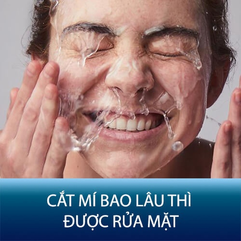 Cắt mí bao lâu thì được rửa mặt? Bạn đã biết cách vệ sinh mí mắt sau phẫu thuật chính xác chưa? 1