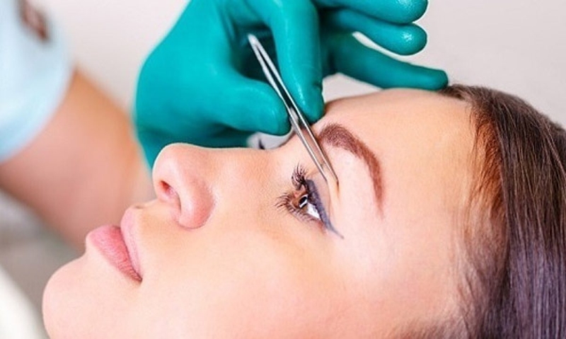 Cắt mí mắt có đau không? Bao lâu thì khỏi? 2