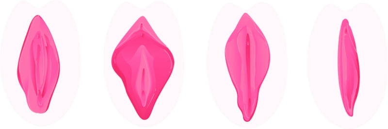 Cắt môi bé bao lâu thì lành? Những điều cần lưu ý khi thực hiện phẫu thuật cắt môi bé 2