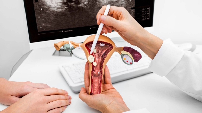 cat-polyp-co-tu-cung-het-bao-nhieu-tien 2.jpg