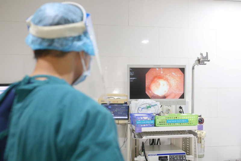 cat-polyp-hau-mon-bao-lau-thi-khoi 3.png