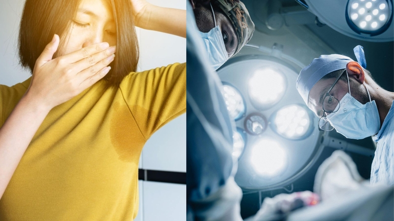 Cắt tuyến mồ hôi nách có hết hôi nách không là băn khoăn của nhiều độc giả