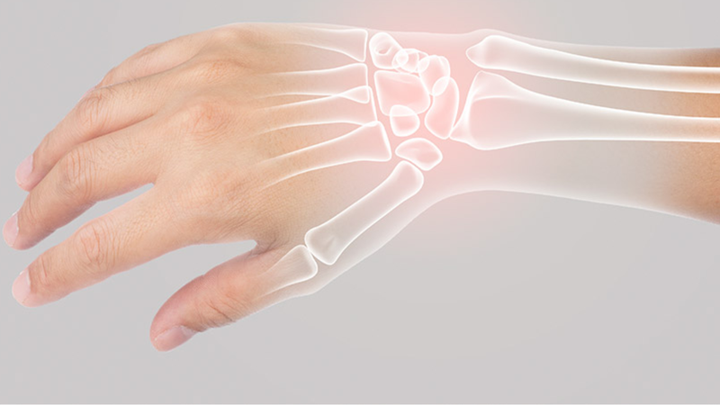Cấu tạo của cổ tay và những chấn thương thường gặp 1