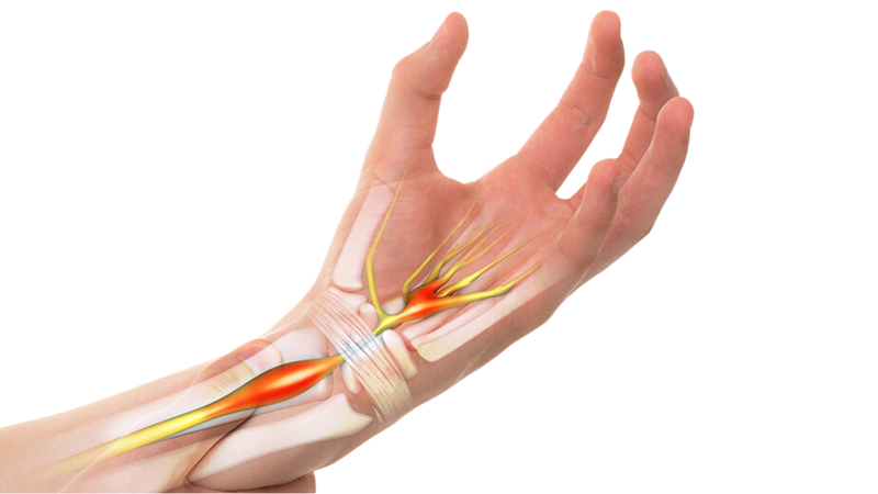 Cấu tạo của cổ tay và những chấn thương thường gặp 2