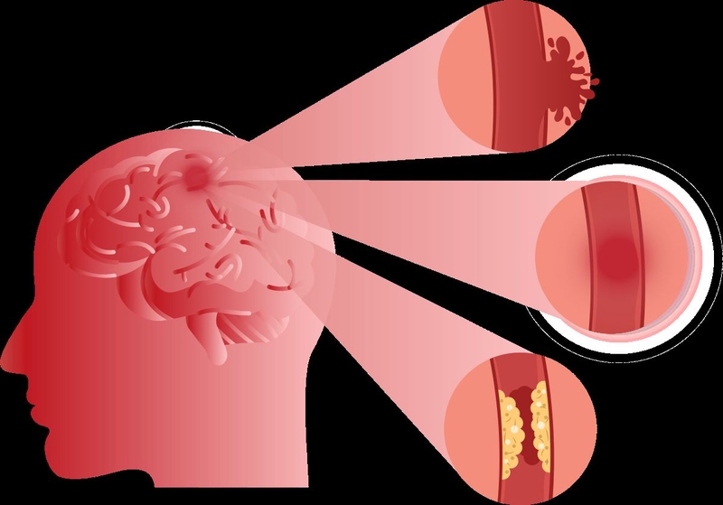 Cấu tạo não người và một số bệnh lý về não 5