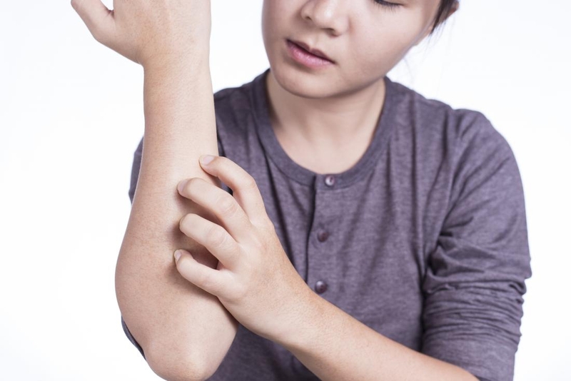 Cấu trúc của da và chức năng của cơ quan này 3