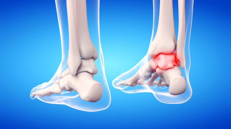 Cấu trúc giải phẫu của khớp cổ chân và các bệnh lý thường gặp 1