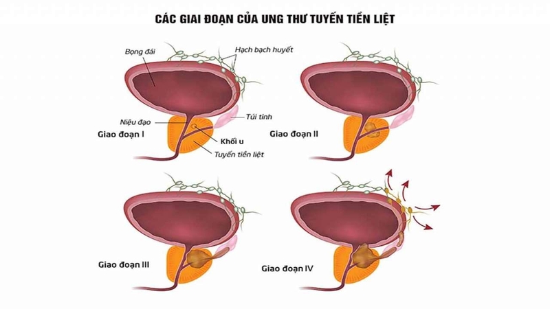 Cây bồ công anh có tác dụng gì? 3