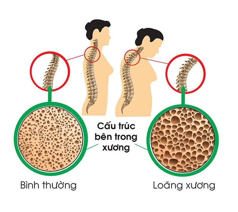 Cây cải ngọt bao nhiêu calo và công dụng của cây cải ngọt -3