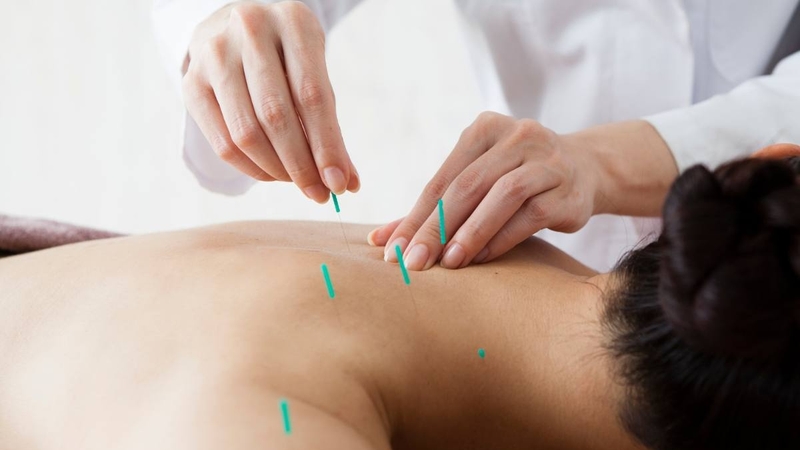 Cấy chỉ chữa đau vai gáy và những điều cần biết 2