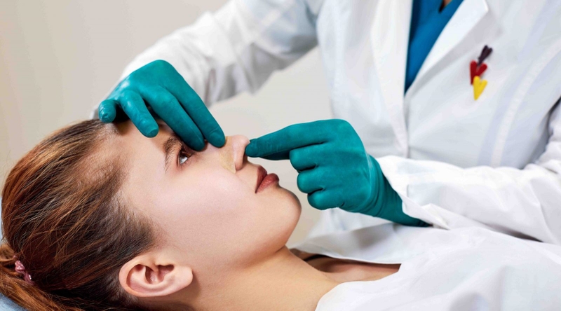 Tiêm filler xong có nâng mũi được không? 3