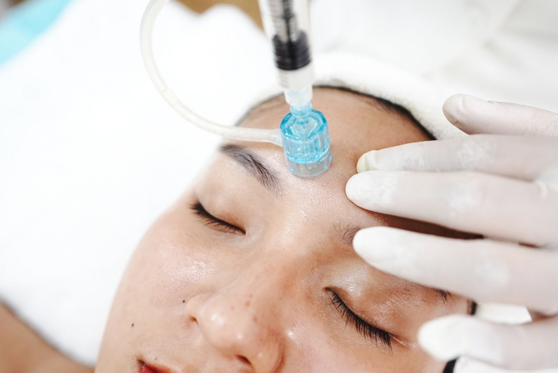 Cấy collagen tươi trẻ hóa da có tốt không? 1