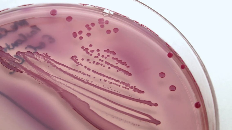 Cấy dịch niệu đạo giúp xác định tác nhân gây viêm nhiễm đường sinh dục - tiết niệu