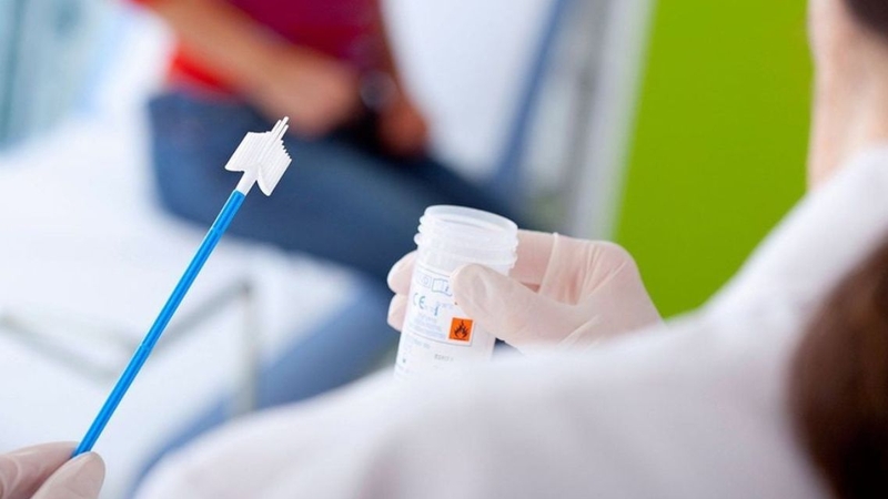 Mẫu dịch niệu đạo được lấy bằng dụng cụ vô trùng, thực hiện nhanh chóng
