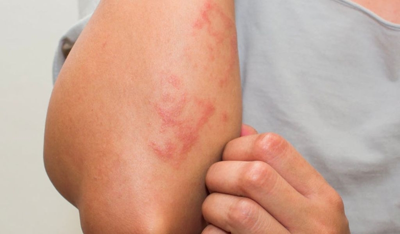 Cây đuôi chuột giúp điều trị bệnh hiệu quả như thế nào? 3