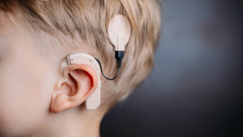 Cấy ghép ốc tai điện tử và những thông tin bạn cần biết 1