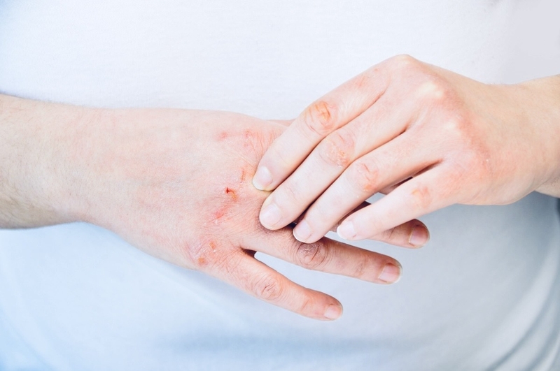 Cây gừng dại có những lợi ích với sức khỏe gì khi sử dụng? - 4