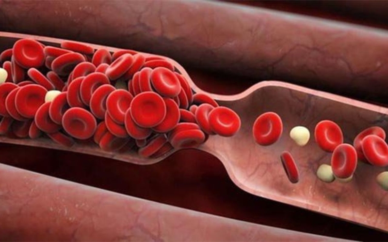 cay-huyet-giac-madagascar-co-tac-dung-gi 3