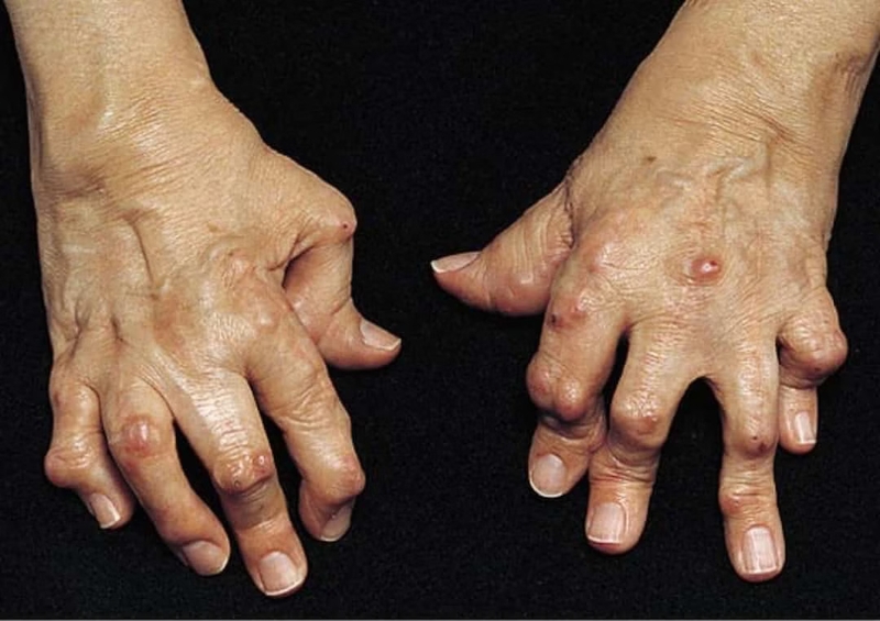 Cây Mắm: Dược liệu quý và những công dụng cho sức khỏe 2