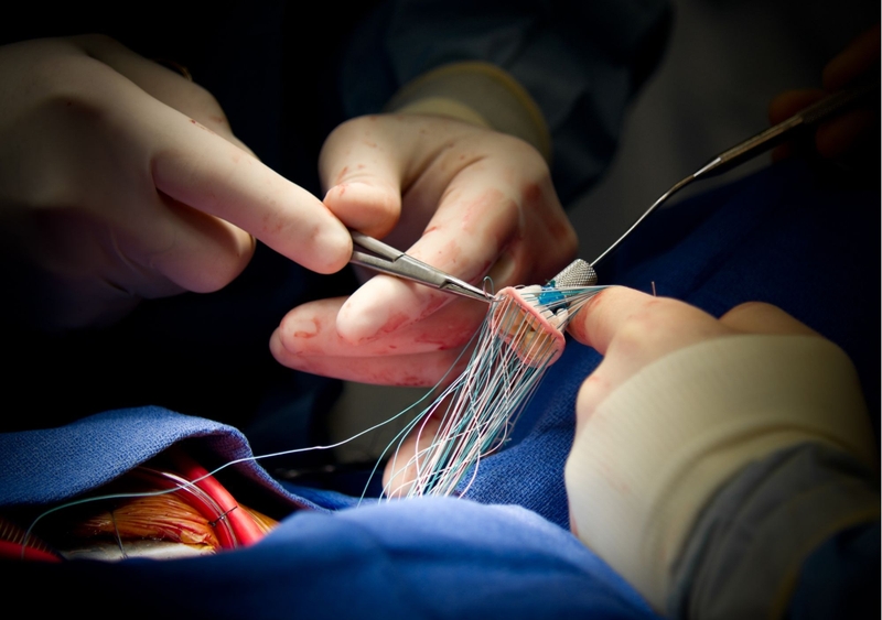 Cấy máu trong chẩn đoán nhiễm khuẩn huyết và những thông tin bạn nên biết 4