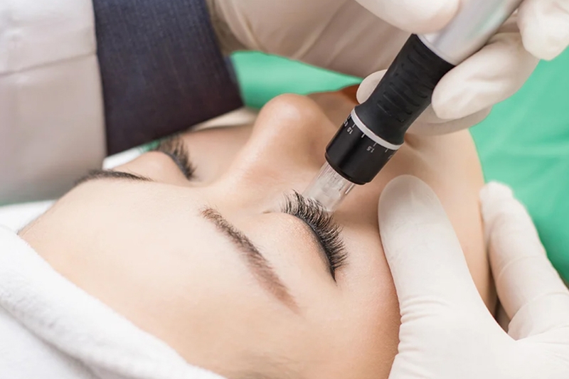 Giải thích cấy mi sinh học nano là gì?