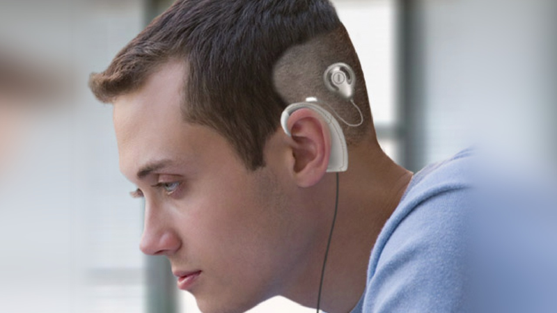 cấy ốc tai điện tử có nguy hiểm không 2