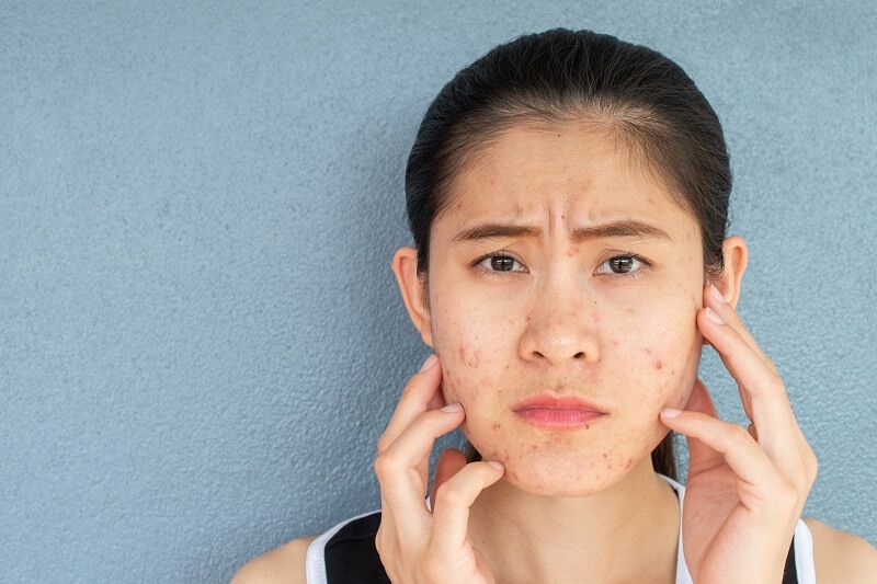 Cấy phấn trắng da có hiệu quả không? Có ảnh hưởng xấu tới da không? 3