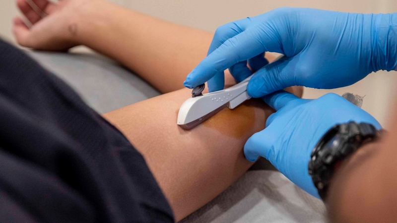 Cấy que tránh thai bị tăng cân phải làm sao? Xử lý như thế nào? 1