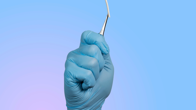 Cấy que tránh thai có để lại sẹo không? Những lưu ý khi cấy que tránh thai 1