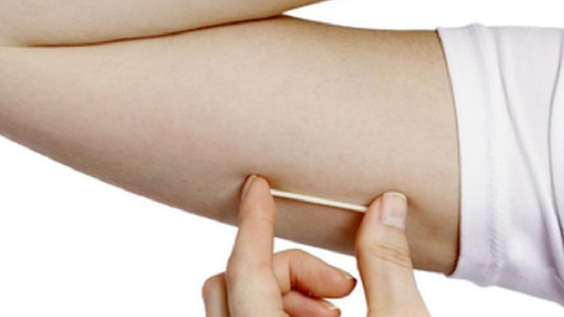 Cấy que tránh thai có gây ung thư không? Phù hợp với đối tượng nào? 1