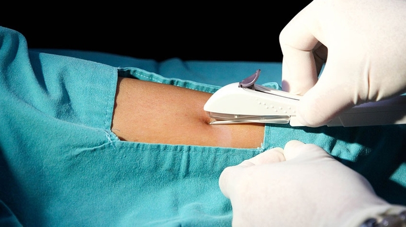 Cấy que tránh thai ở đâu? Những tiêu chí lựa chọn địa chỉ cấy que tránh thai 1