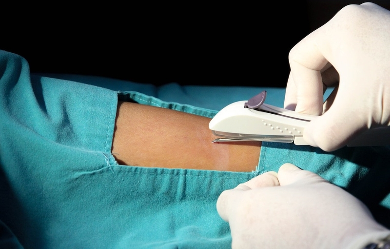 Có nên cấy que tránh thai sau sinh mổ không? Đâu là thời điểm thích hợp 2