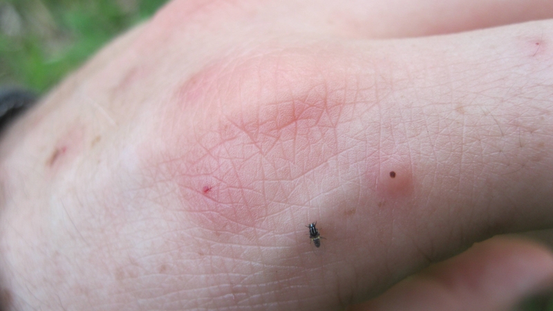 Thóc lép được dùng trong trường hợp sưng tấy hoặc côn trùng đốt