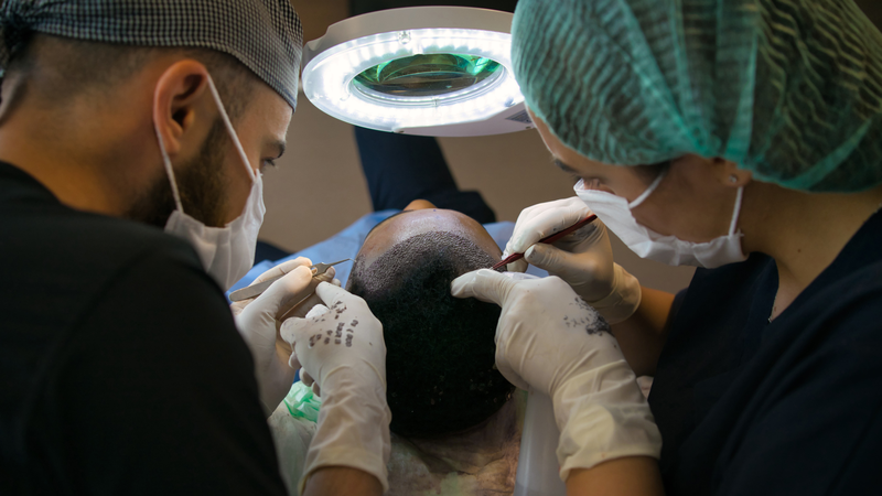 Cấy tóc bao nhiêu tiền? Những lưu ý về giá và những thắc mắc phổ biến 2