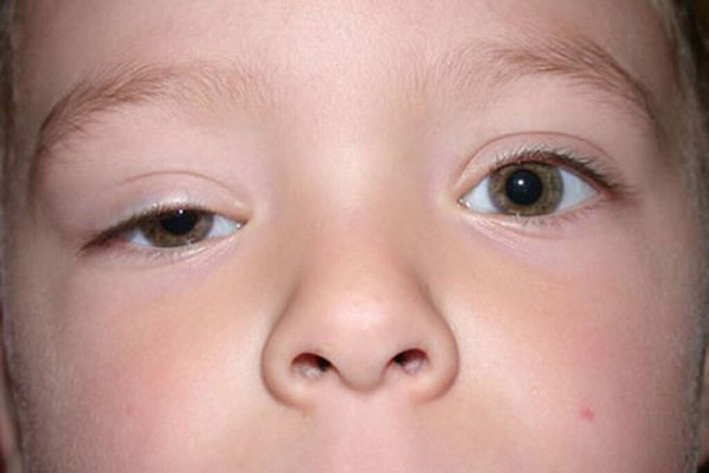 Cây vông nem có tác dụng gì? 6