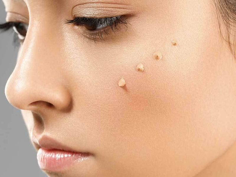 CC cream là gì? Một vài lưu ý khi sử dụng CC cream 1