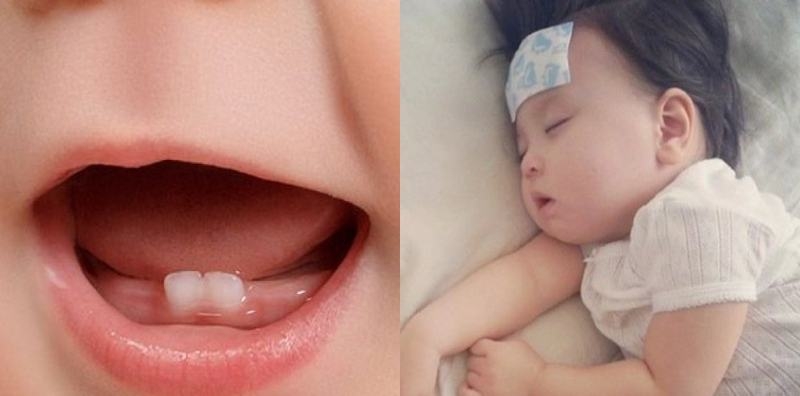 Cha mẹ cần làm gì khi trẻ bị viêm lợi và sốt cao 1