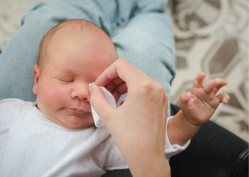 Cha mẹ nên làm gì khi trẻ bị sốt và sưng mắt? 3